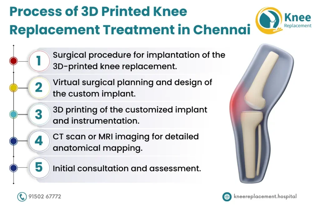 3D Printed Knee Replacement treatment in Chennai 