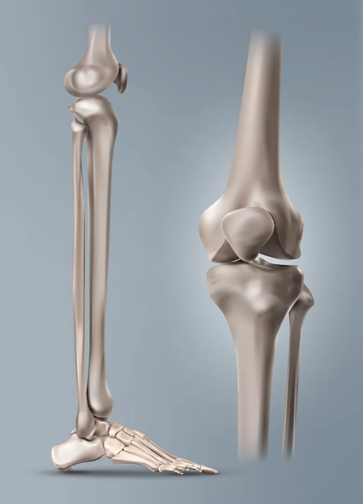 Knee Replacement 3