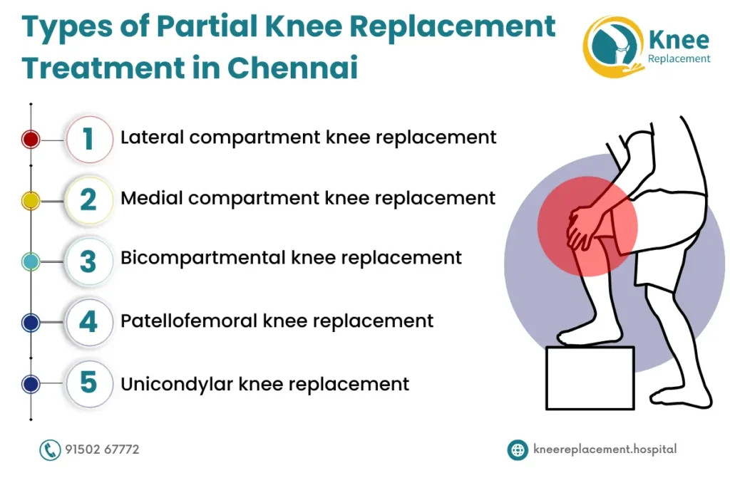 Partial Knee Replacement in Chennai