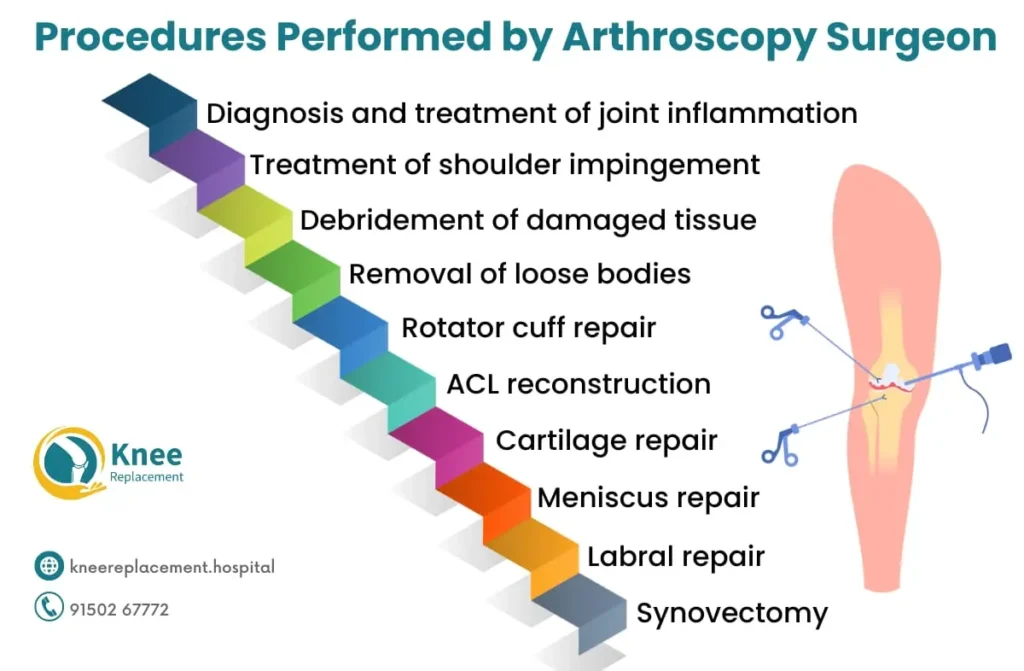 Arthroscopy Surgeon in Chennai