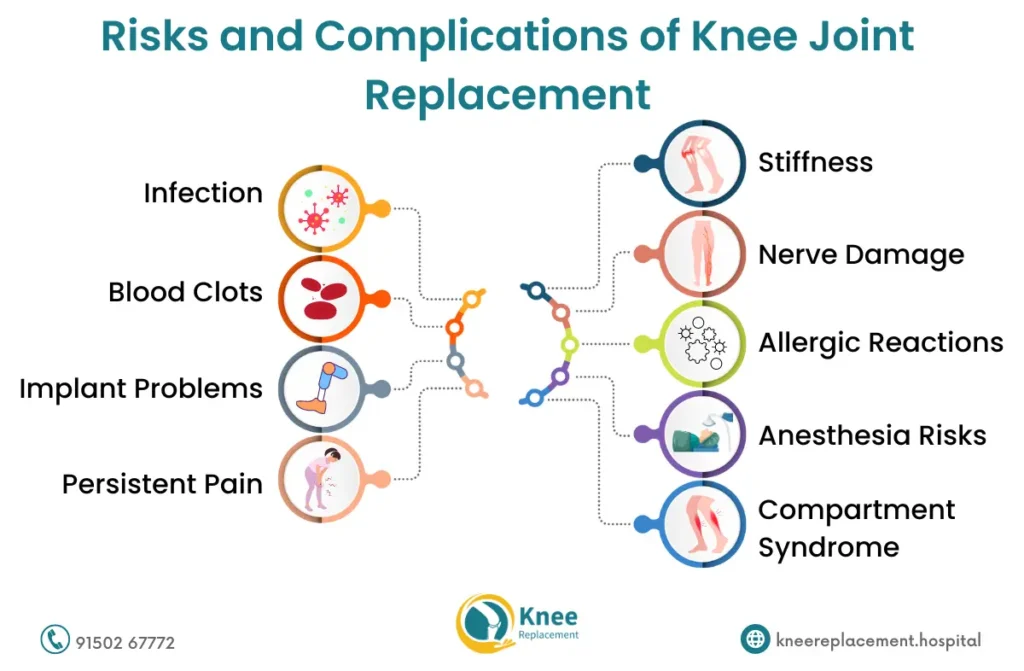 Knee Joint Replacement in Chennai