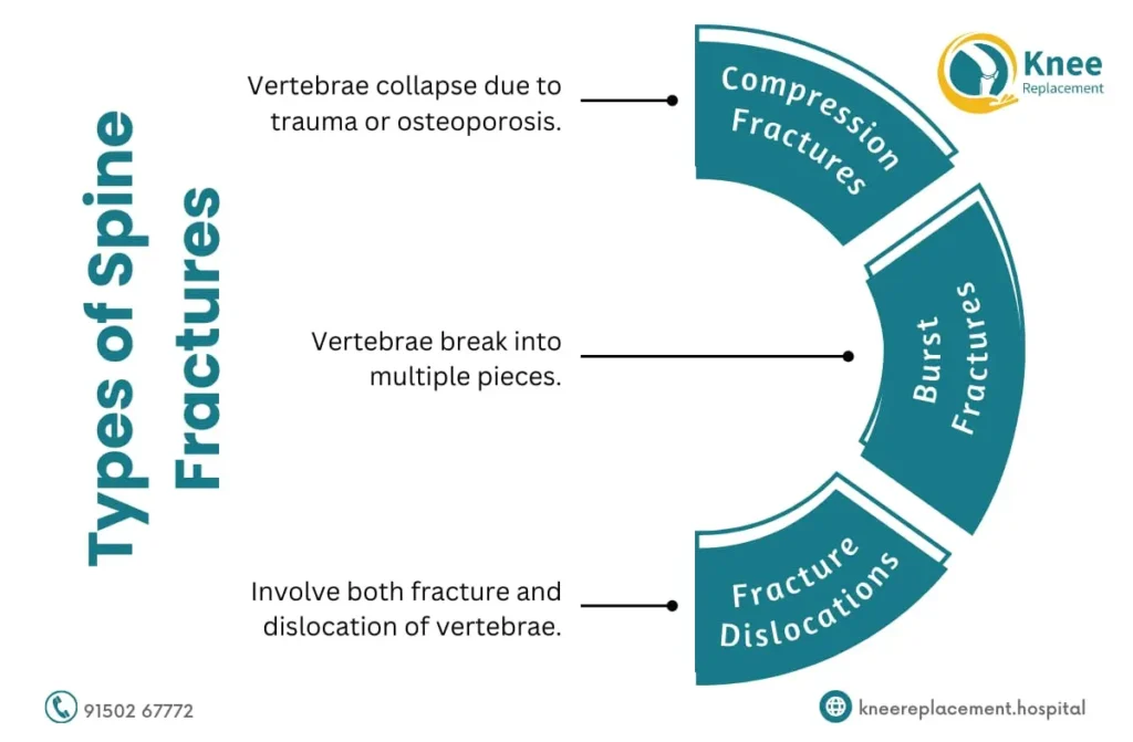 Fracture Treatment in Chennai