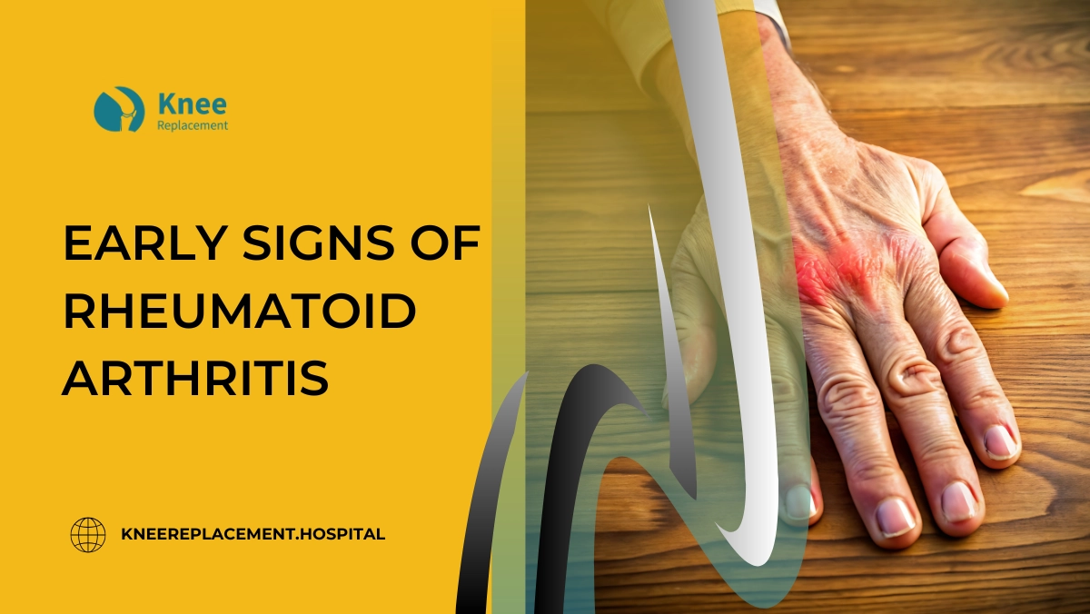 Early Signs of Rheumatoid Arthritis