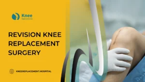 revision knee replacement surgery