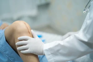 Ceramic Total Knee Replacement