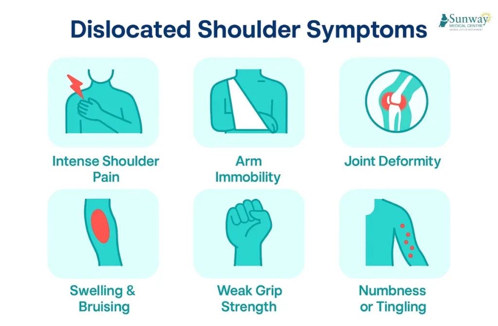 Dislocated Shoulder Symptoms 1 Dislocated Shoulder Symptoms