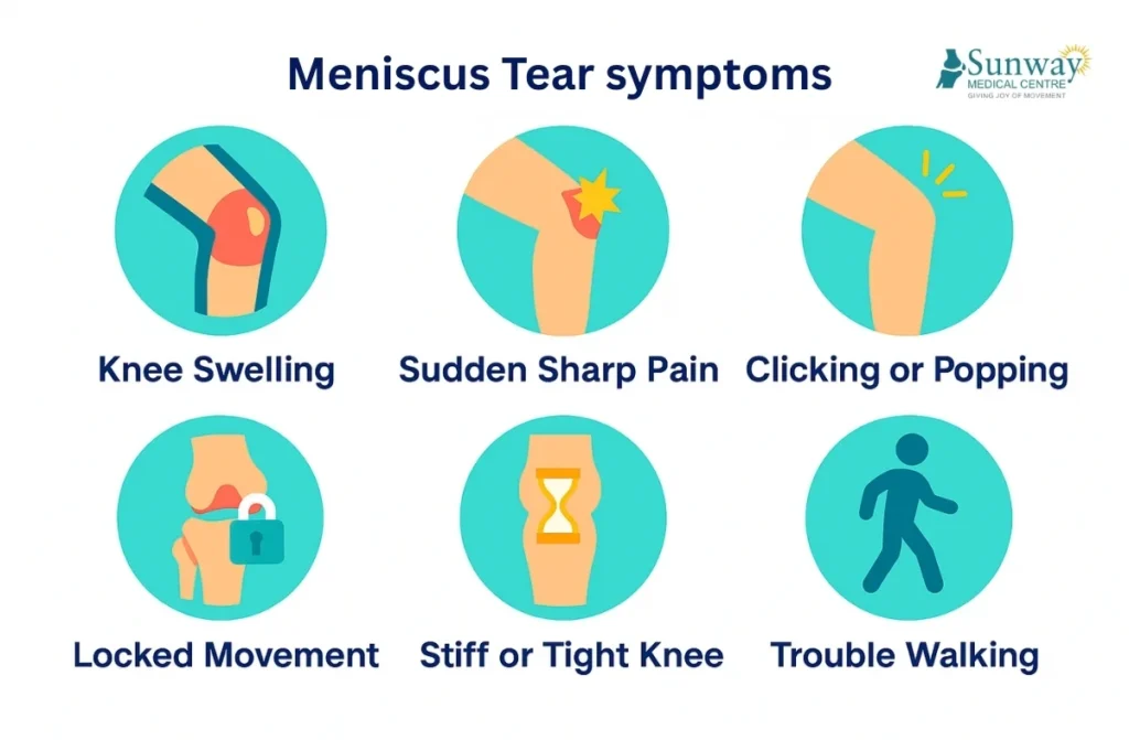 Surgery for Meniscus Tears .jpg