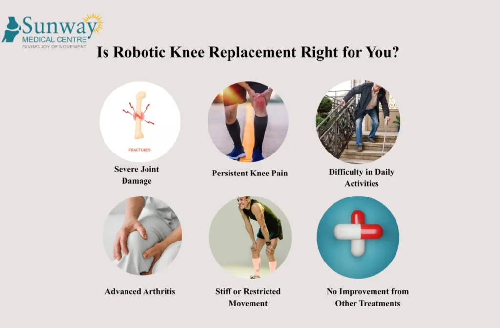 robotic knee replacement surgeryinfo
